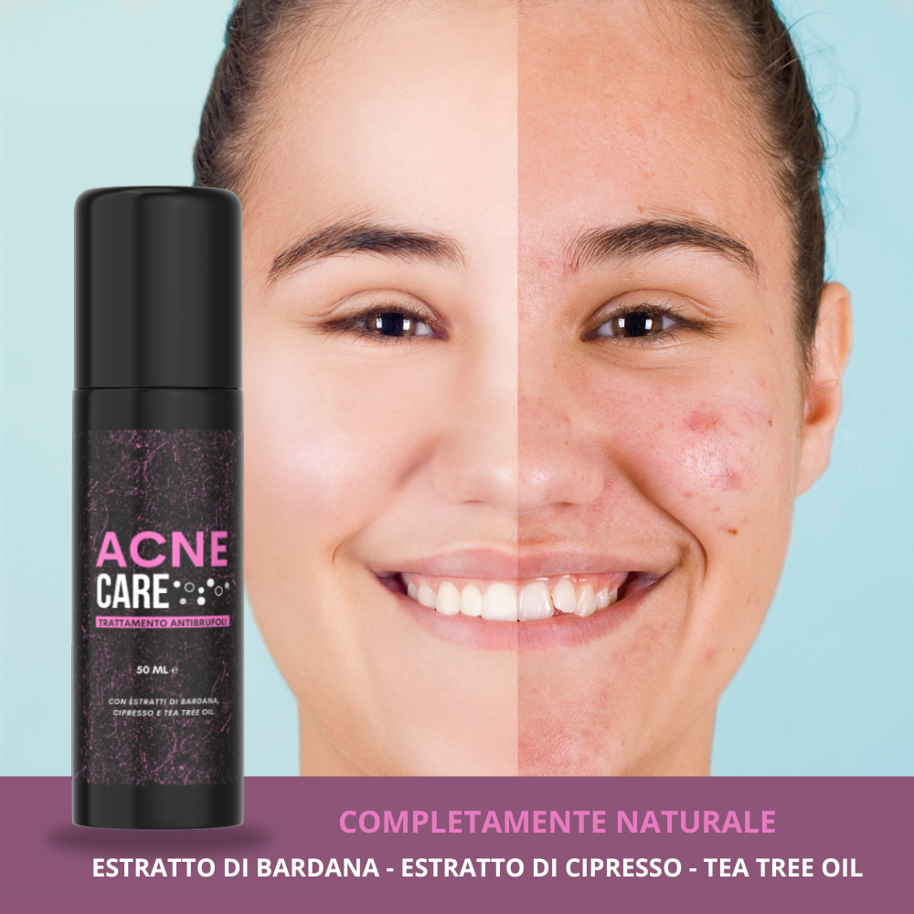 ACNE CARE – Gel Purificante Anti-Imperfezioni Klondo