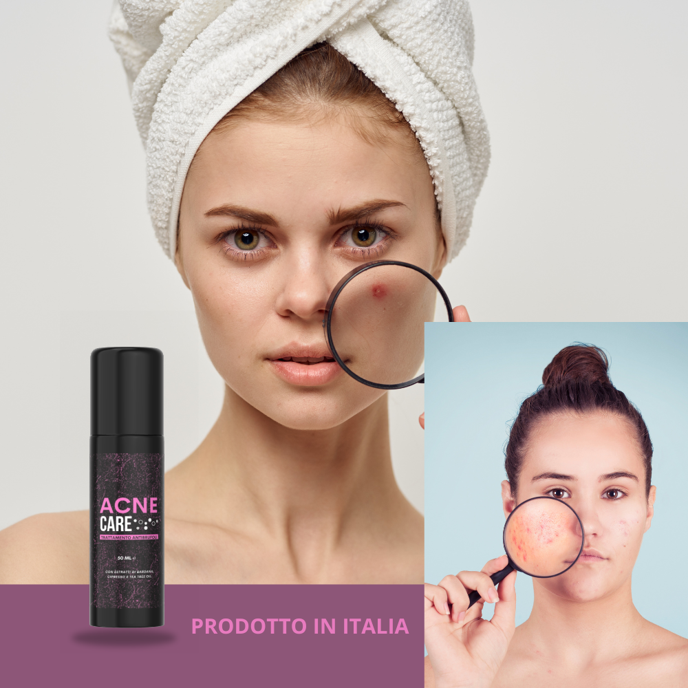 ACNE CARE – Gel Purificante Anti-Imperfezioni Klondo