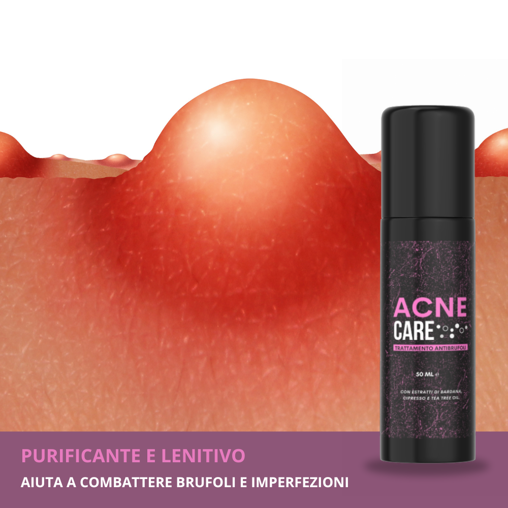 ACNE CARE – Gel Purificante Anti-Imperfezioni Klondo
