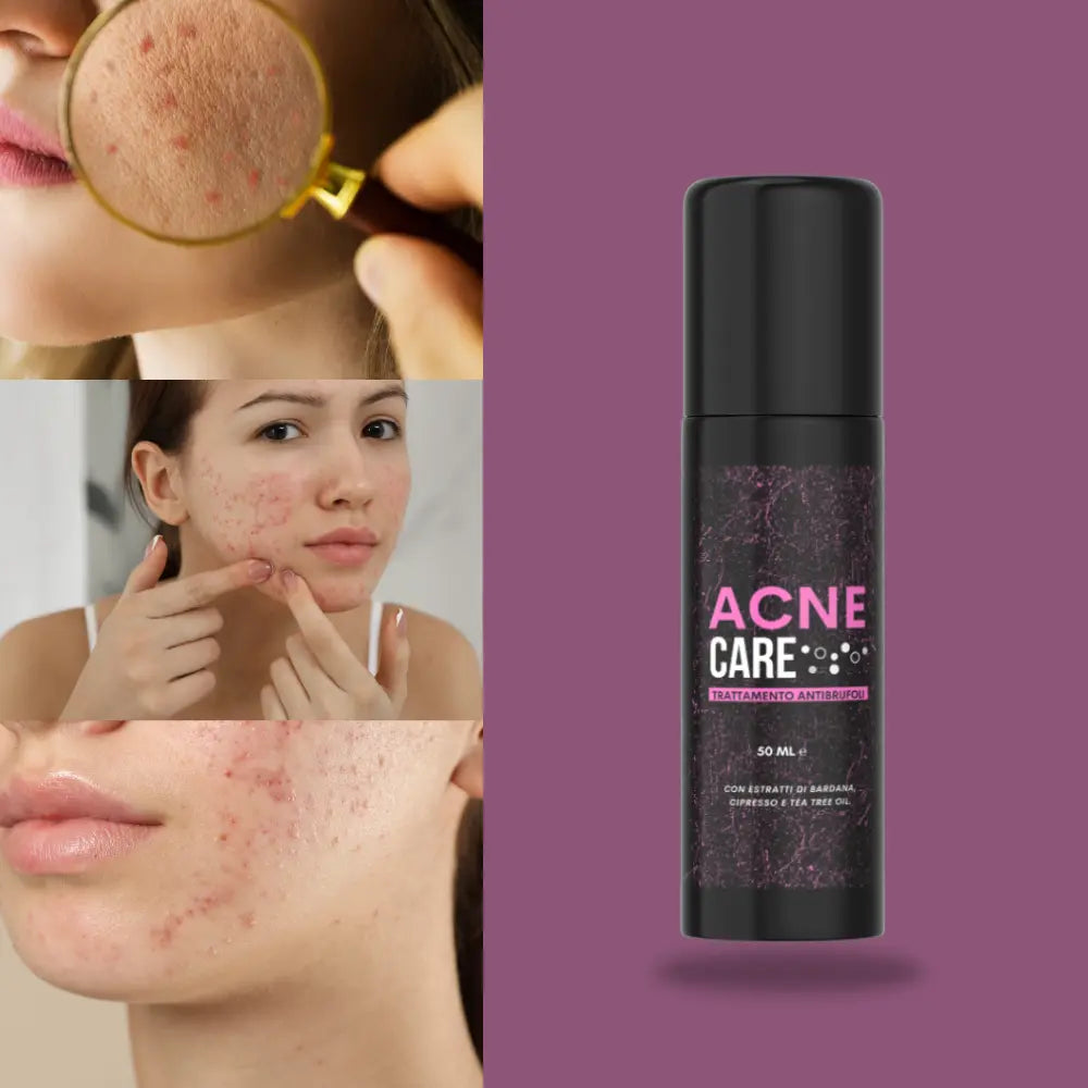 Acne Care Hinoki Milano